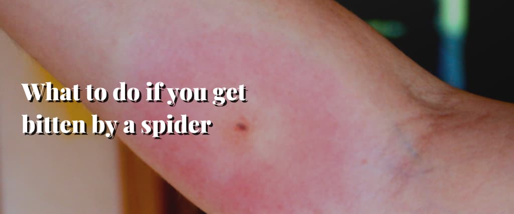 What to do if you get bitten by a spider